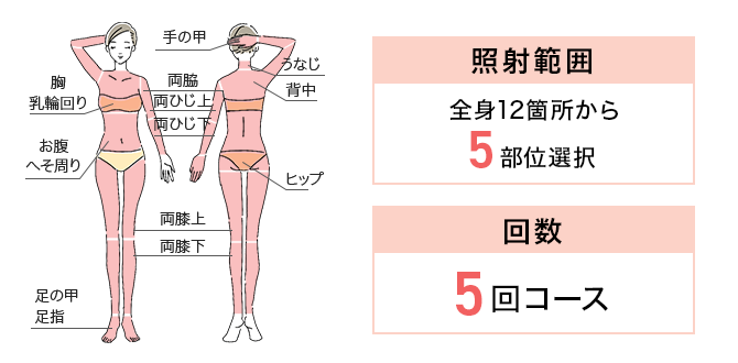 セレクト脱毛5回セット 照射範囲