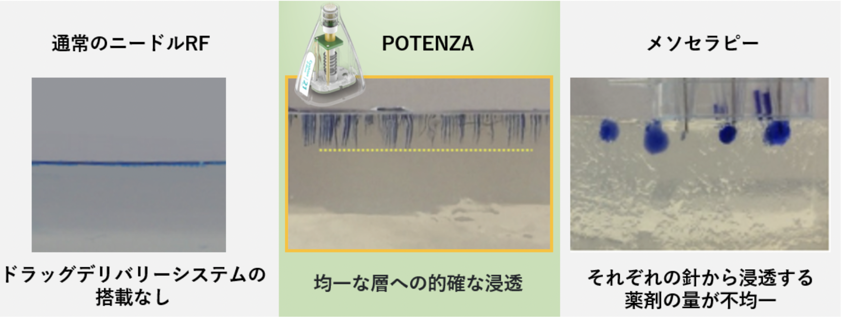 ポテンツァの肌内部(真皮層)への浸透