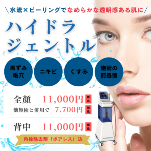 ハイドラジェントル