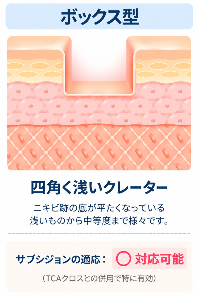 ボックスカー型