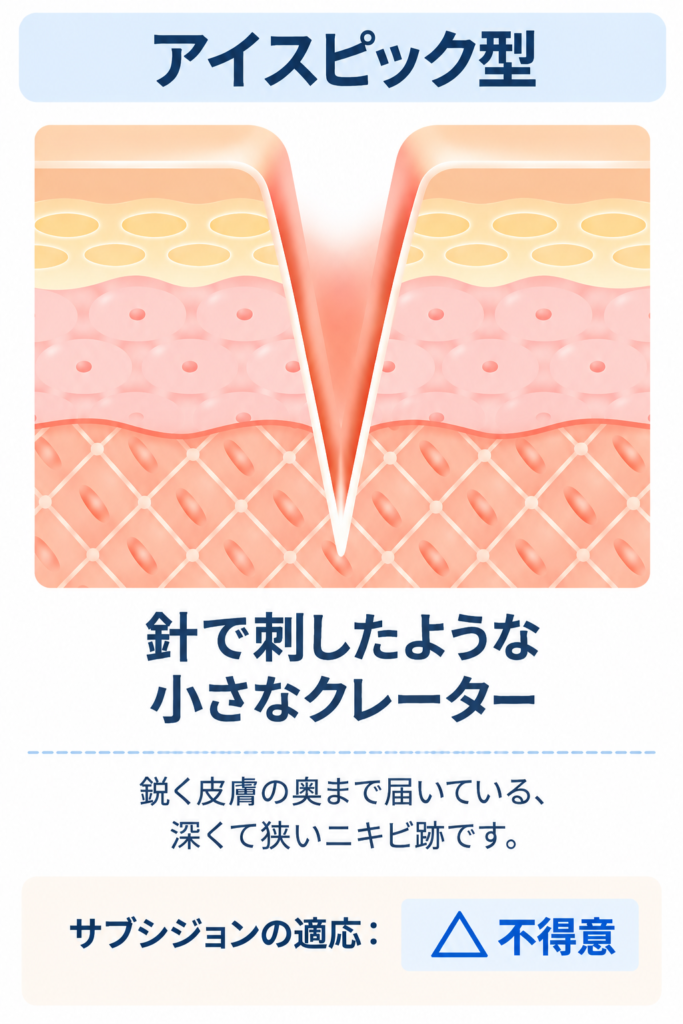 アイスピック型