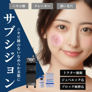 サブシジョン