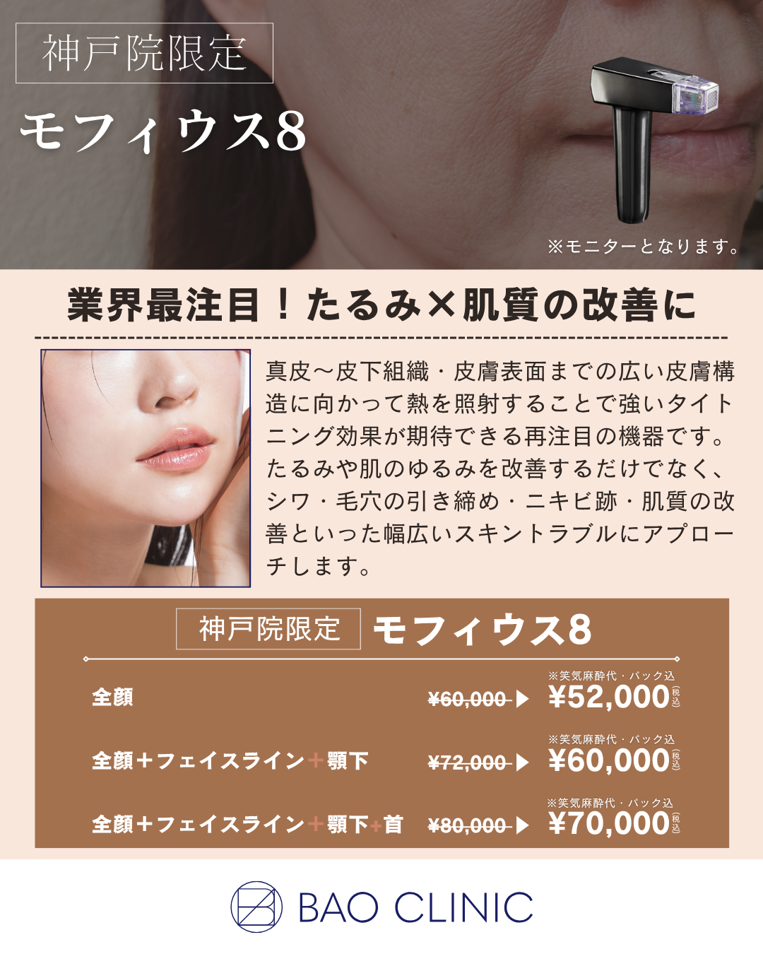 モフィウス8CP（神戸院）