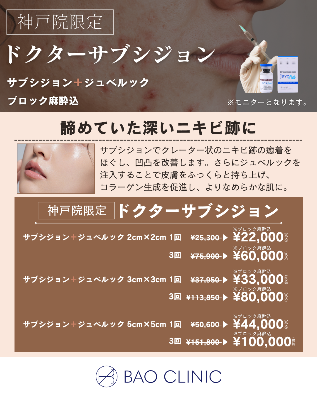 ドクターサブシジョン（神戸院）
