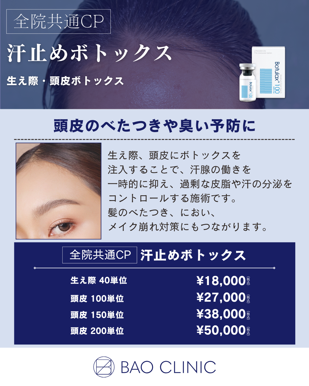 汗止めボトックス（全院）