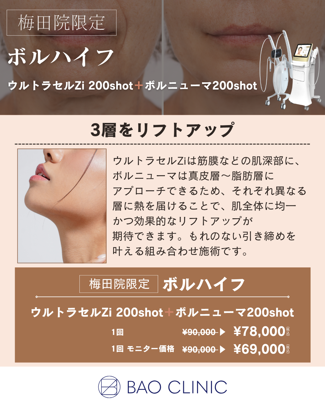 ボルハイフCP（梅田院）