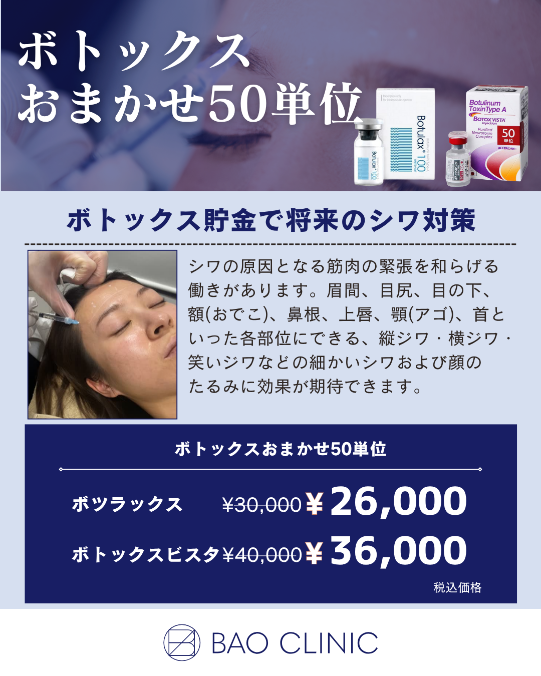 ボトックス おまかせ50単位CP