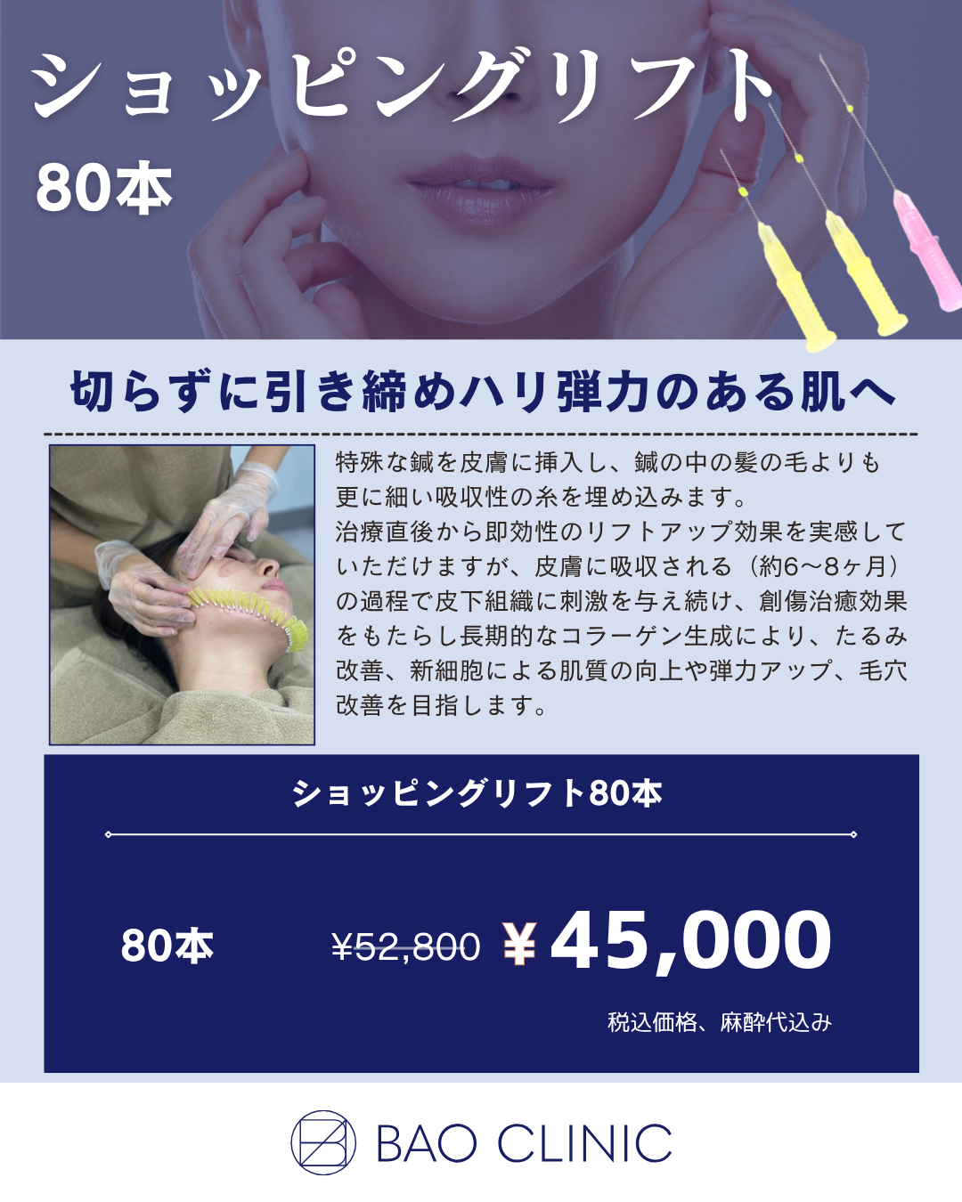 ショッピングリフト80本CP