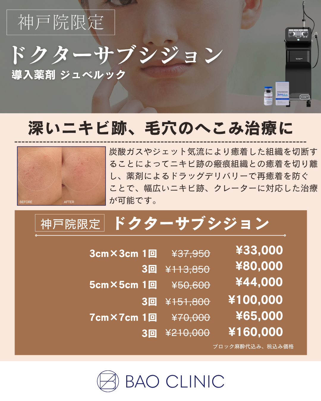 ドクターサブシジョンCP