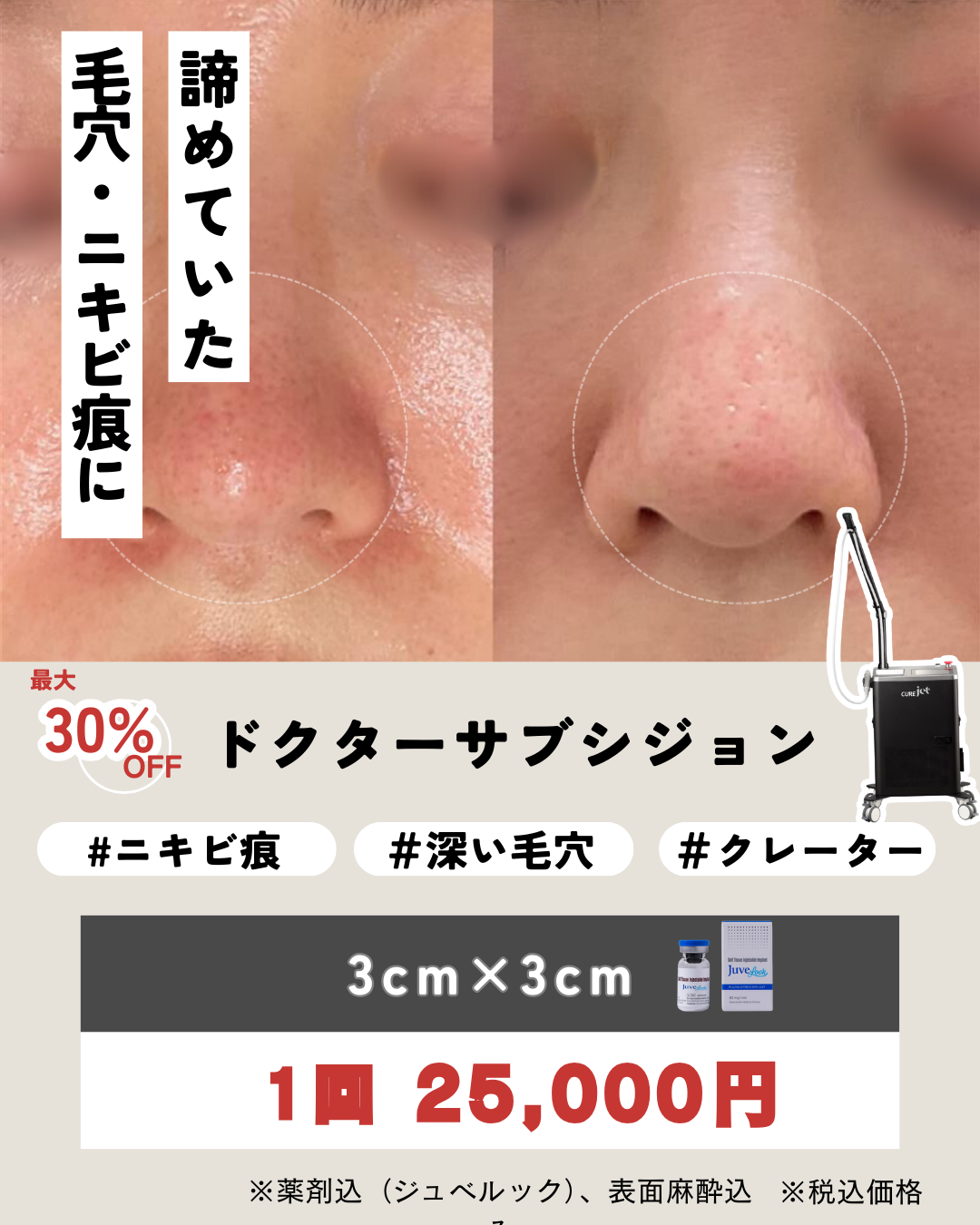 毛穴・ニキビに！ドクターサブシジョンCP