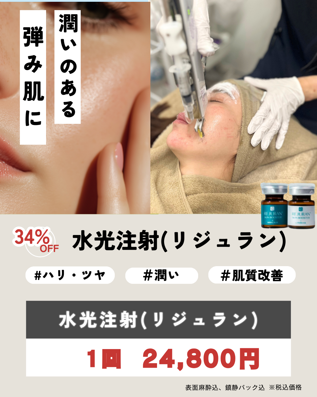 肌質改善！水光注射（リジュラン）CP