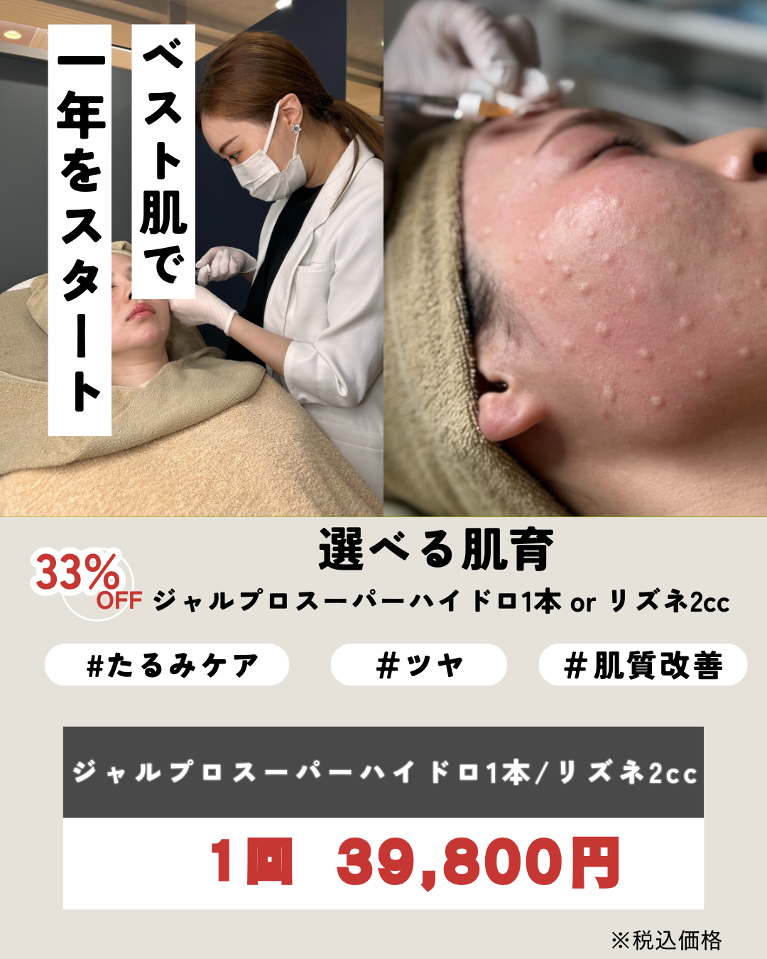 選べる肌育注射CP（スーパーハイドロ or リズネ）