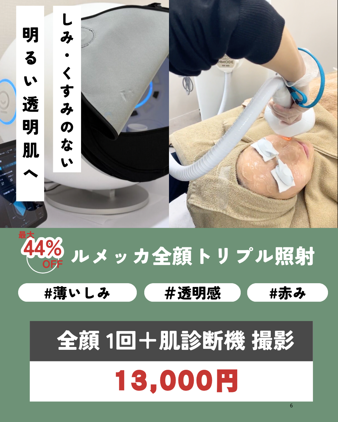 肌診断機撮影付き！ルメッカCP