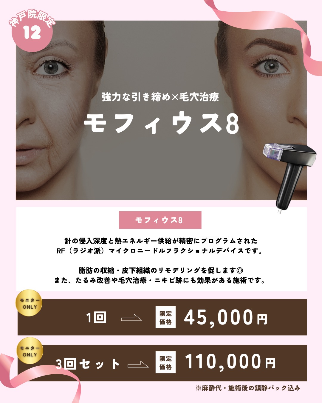 引き締め×毛穴治療！モフィウスモニターCP