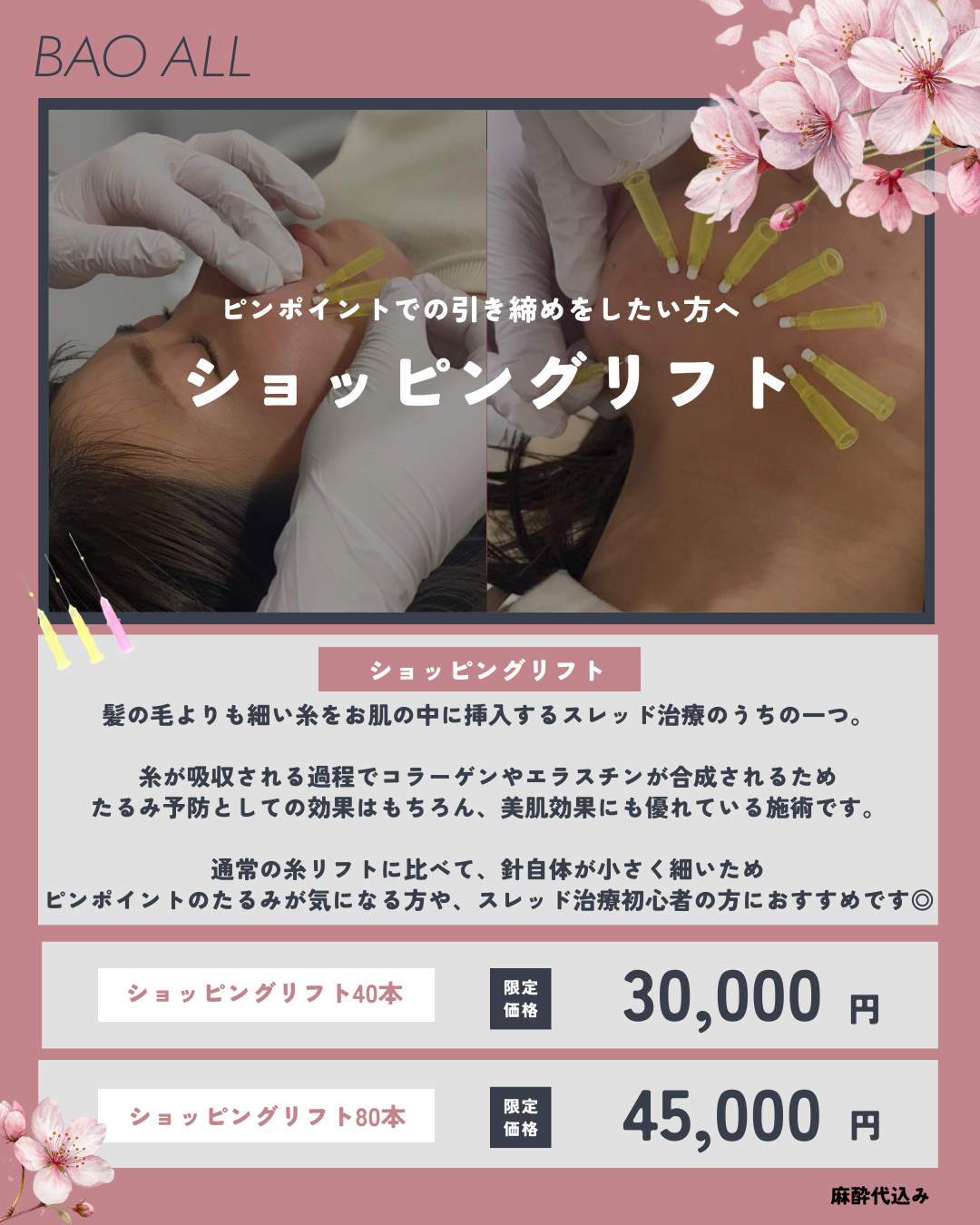 ピンポイントで引き締め！ショッピングリフトCP