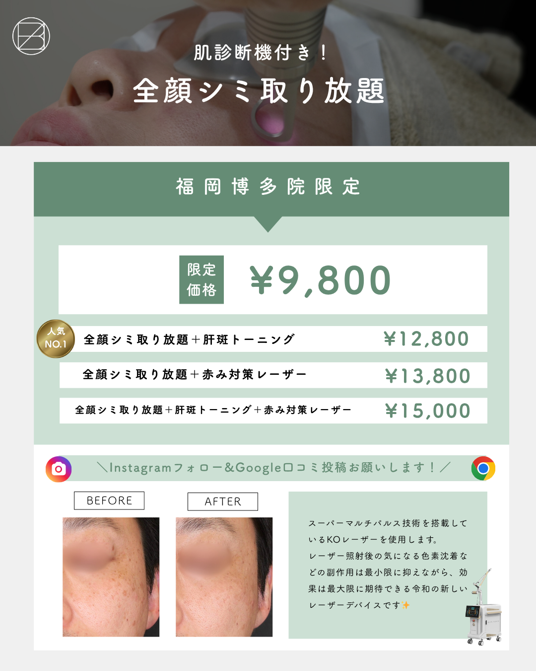 肌診断機付き！全顔シミ取り放題