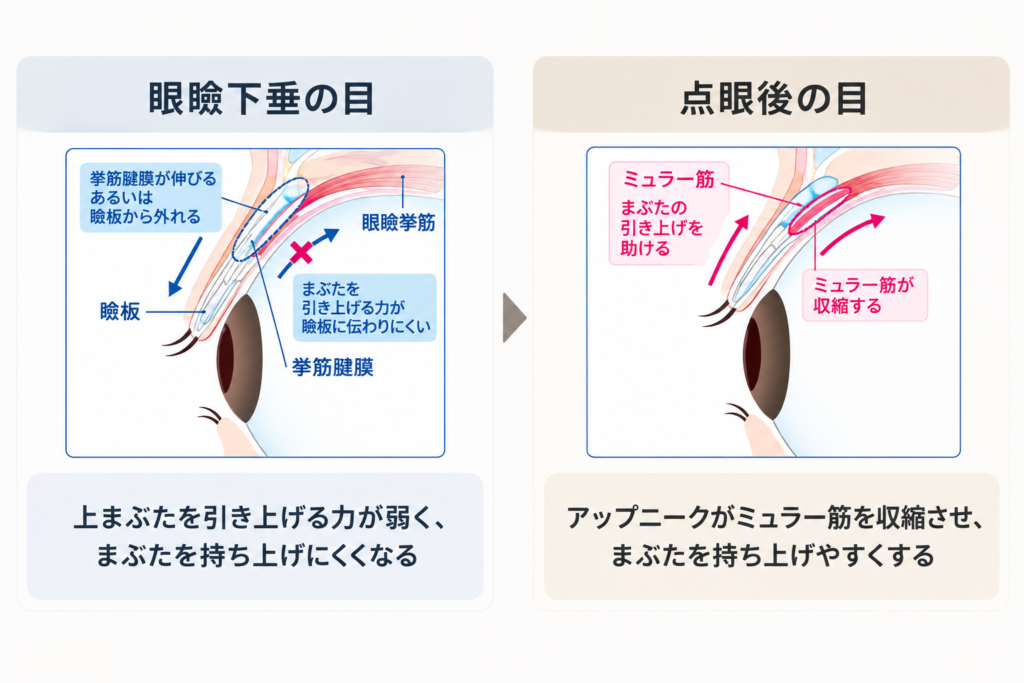 目薬でまぶたの下がりを改善
